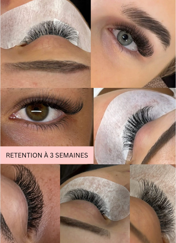 COLLE - Rétention Extrême
